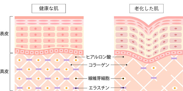 コラーゲン